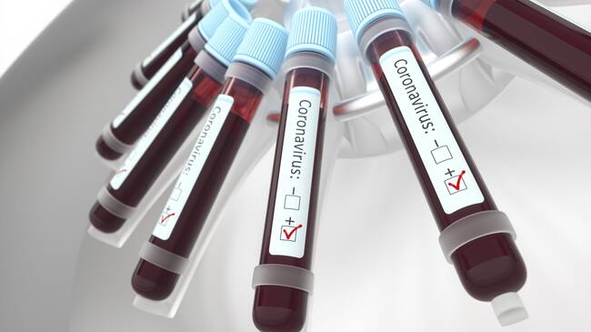 Coronaviruses research, conceptual illustration. Vials of blood in a centrifuge being tested for coronavirus infection.