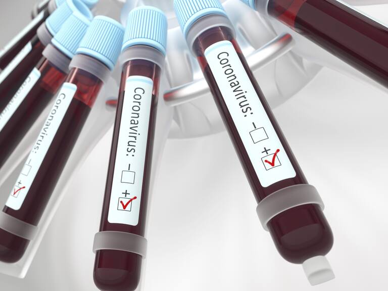 Coronaviruses research, conceptual illustration. Vials of blood in a centrifuge being tested for coronavirus infection.