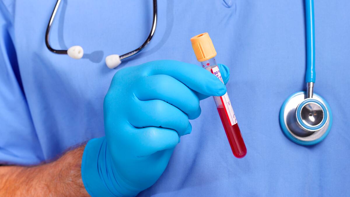 Nuevo test de sangre detecta el Alzheimer con 92% de precisión: ¿Cómo funciona?