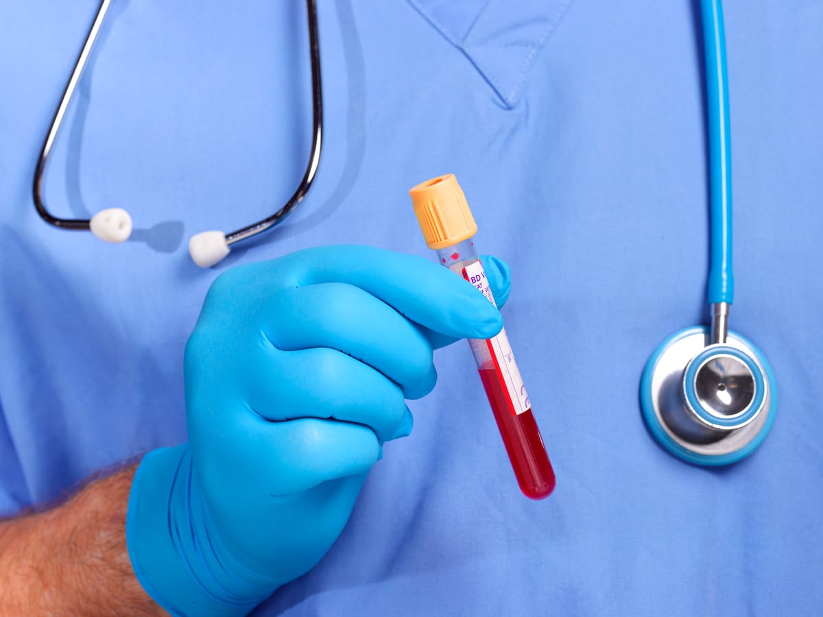 Nuevo test de sangre detecta el Alzheimer con 92% de precisión: ¿Cómo funciona?