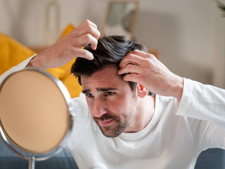 Pérdida de cabello
