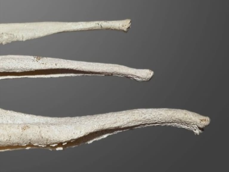 Estudio explica por qué los humanos perdieron el hueso del pene