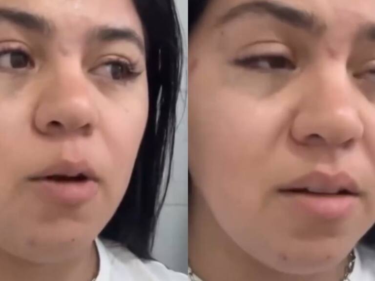 “Cuando te dicen que en Chile hay xenofobia, no es exageración”: extranjera denuncia grave ataque en La Vega