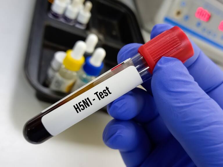 Gripe aviar en Chile: Minsal llama a «no alarmarse» y asegura que «no hay evidencia de transmisión entre personas»