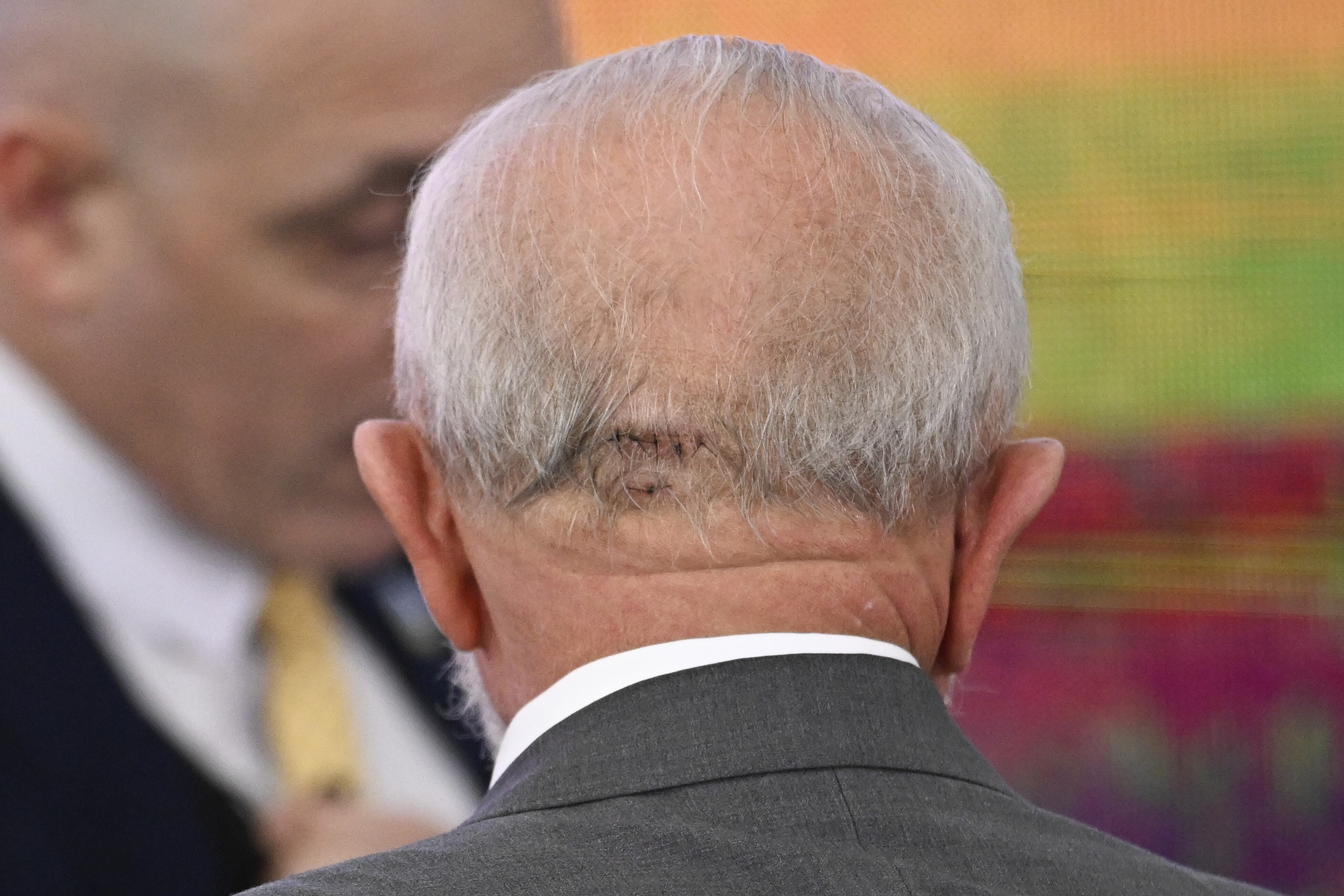 Foto: Getty Images