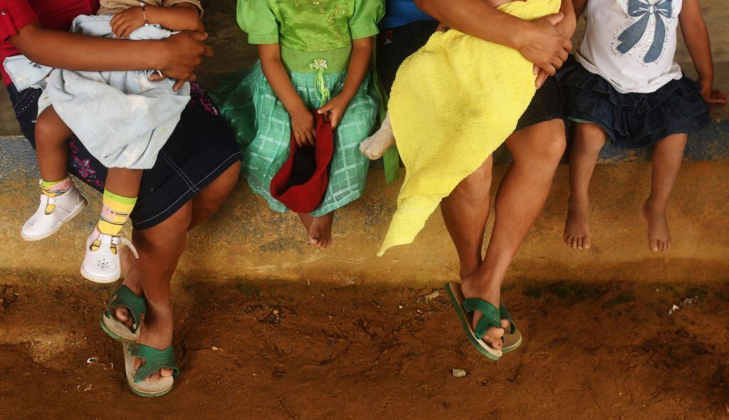 Niños con malnutrición en la municipalidad de Jocotan