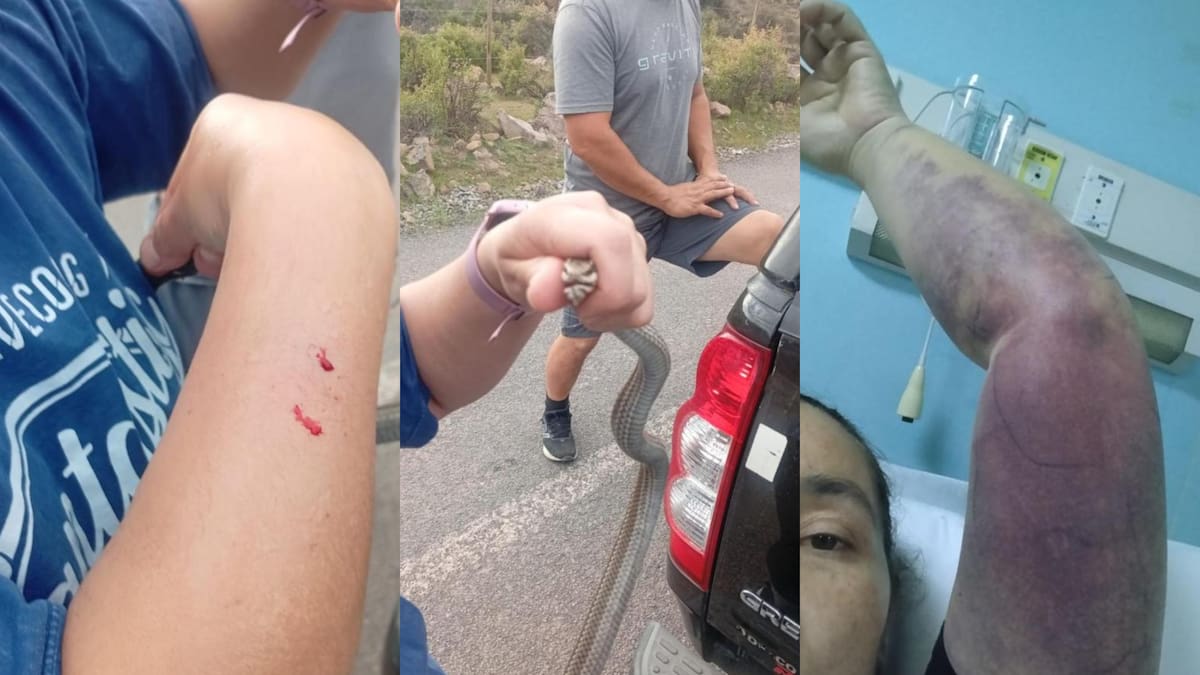 Intentó salvarla de ser atropellada y terminó hospitalizada: mujer sufre mordedura de culebra en Putaendo