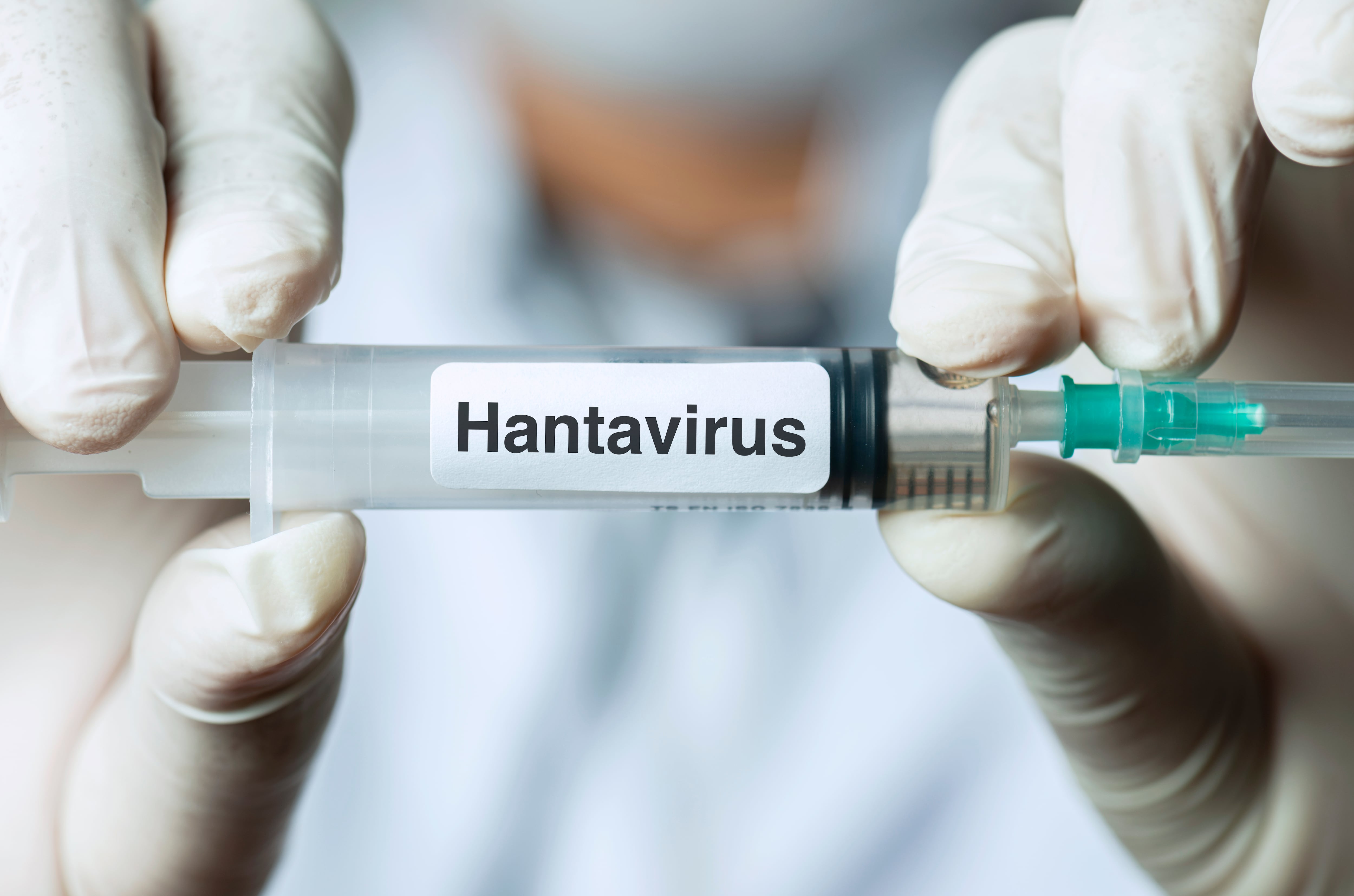 Hallazgo de científicos chilenos podría explicar por qué algunos pacientes desarrollan hantavirus grave
