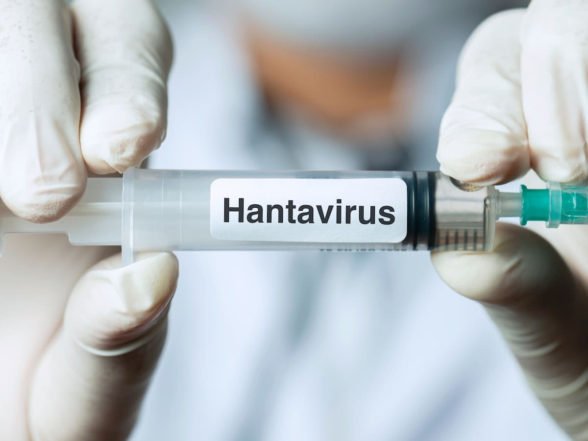 Hallazgo de científicos chilenos podría explicar por qué algunos pacientes desarrollan hantavirus grave