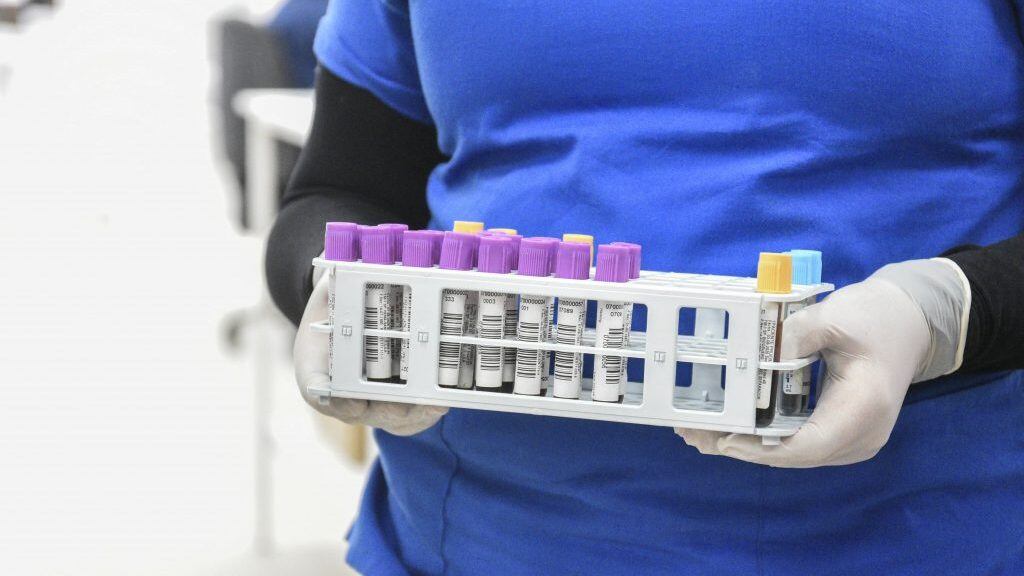 20 DE AGOSTO DE 2020 / VALPARAISOUna funcionaria de salud sostiene muestras medicas, durante visita de las autoridades al Laboratorio Clínico Popular que implemento un sistema automático para la realización de exámenes PCR, como una forma de apoyo a la red de salud.
FOTO: MIGUEL MOYA / AGENCIAUNO
