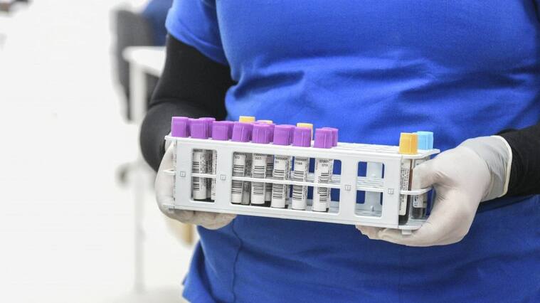 20 DE AGOSTO DE 2020 / VALPARAISOUna funcionaria de salud sostiene muestras medicas, durante visita de las autoridades al Laboratorio Clínico Popular que implemento un sistema automático para la realización de exámenes PCR, como una forma de apoyo a la red de salud.
FOTO: MIGUEL MOYA / AGENCIAUNO
