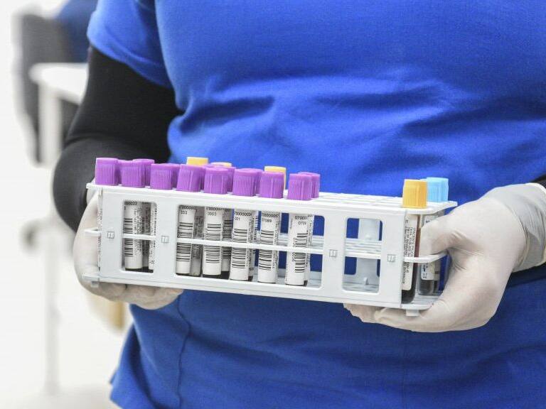 20 DE AGOSTO DE 2020 / VALPARAISOUna funcionaria de salud sostiene muestras medicas, durante visita de las autoridades al Laboratorio Clínico Popular que implemento un sistema automático para la realización de exámenes PCR, como una forma de apoyo a la red de salud.
FOTO: MIGUEL MOYA / AGENCIAUNO