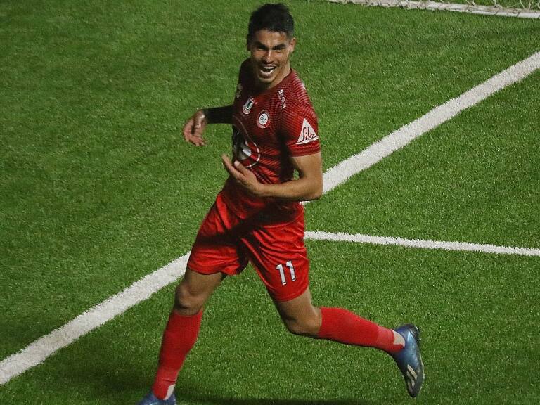 Erick Wiemberg es operado y su tiempo de recuperación en Unión La Calera será "extenso"