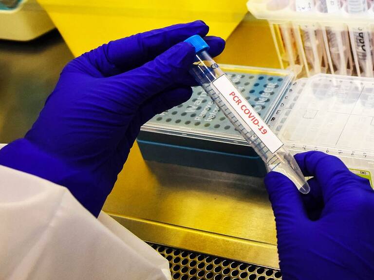 Ministerio de Salud reportó 54 muertos por Covid-19 durante las últimas 24 horas, llegando a un total de 15.410