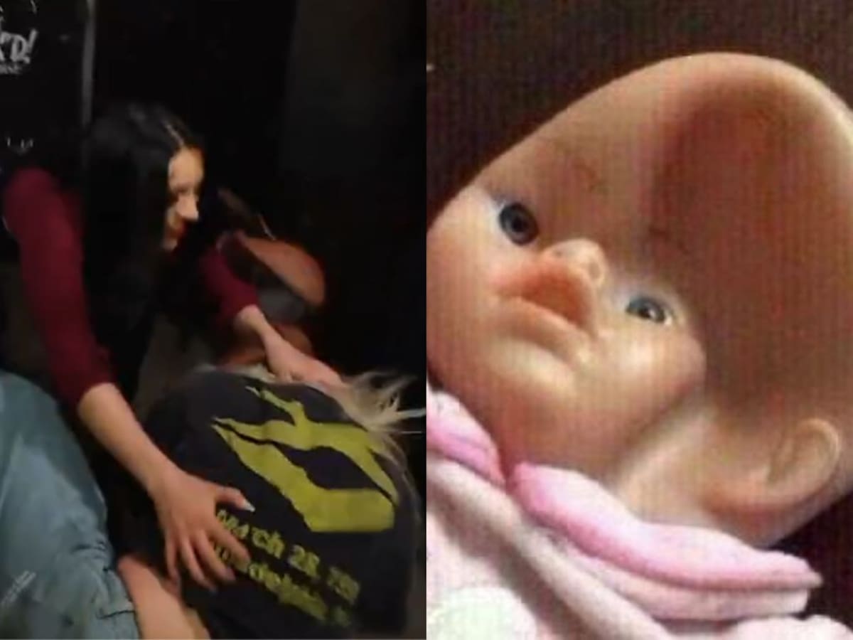 Brutal golpiza: luchadora estadounidense muestra impactante lesión tras ataque de la chilena Stephanie Vaquer