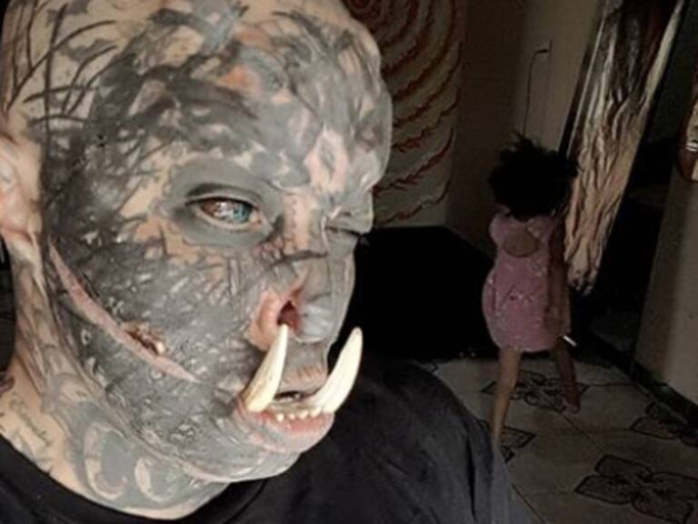 Tatuador se implantó colmillos en la mandíbula inferior para verse como un orco