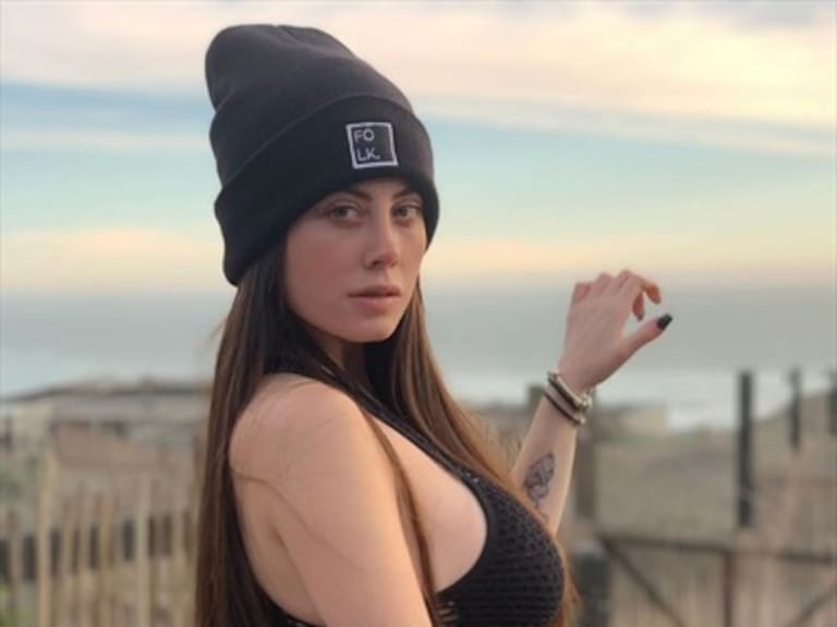 Ignacia Michelson descubrió que le inyectaron metacril en sus glúteos