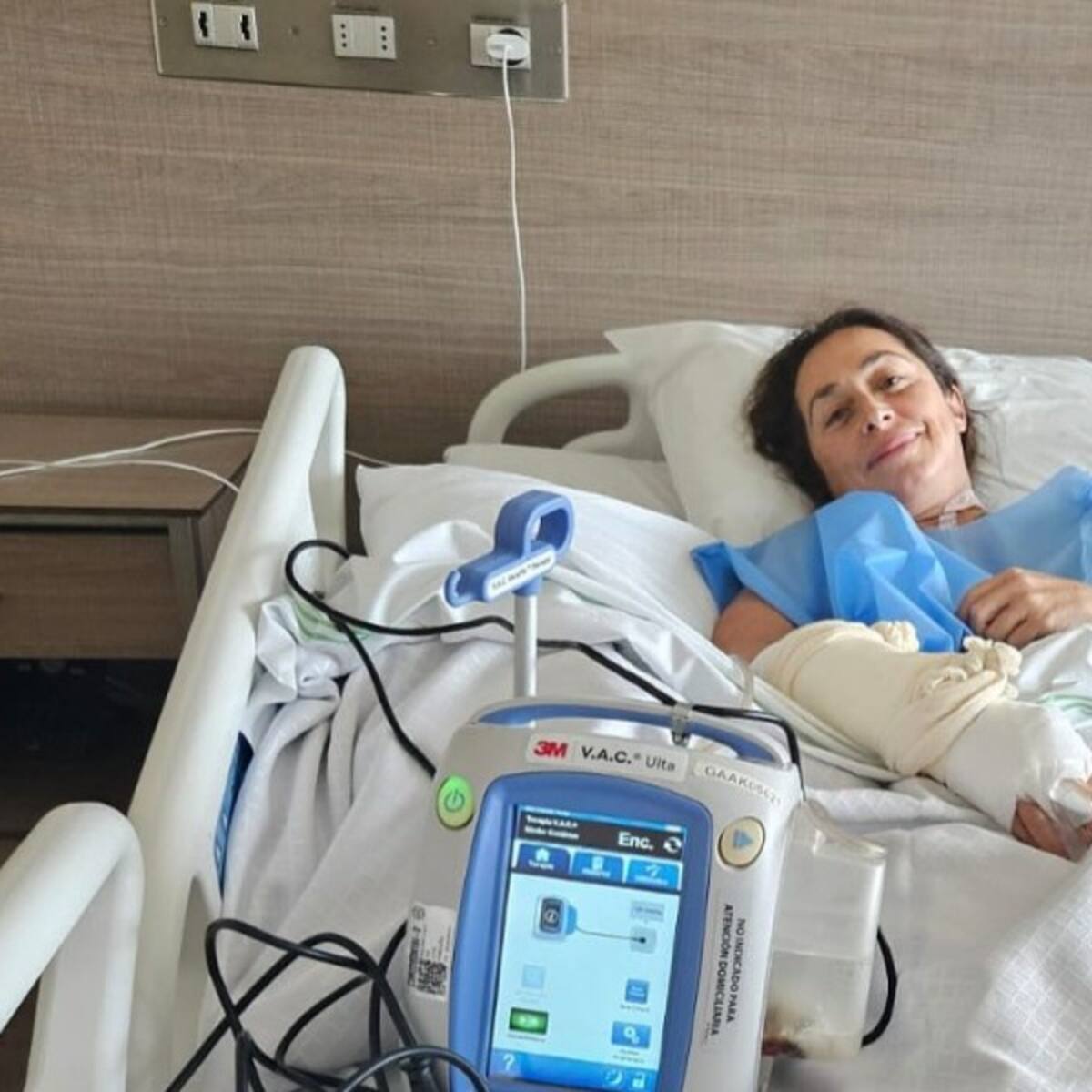“Estuve a punto de perder el brazo”: el drama de deportista chilena que sufrió una picadura de araña de rincón