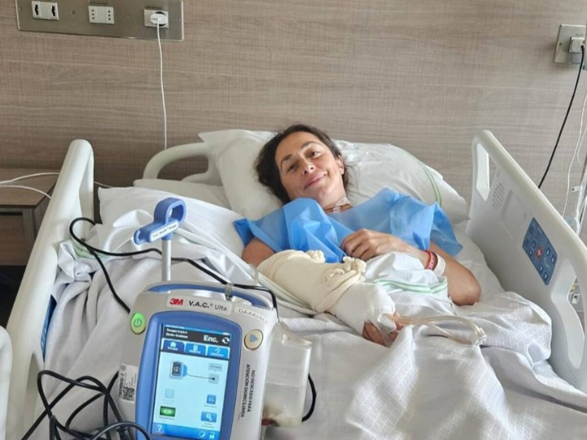 “Estuve a punto de perder el brazo”: el drama de deportista chilena que sufrió una picadura de araña de rincón