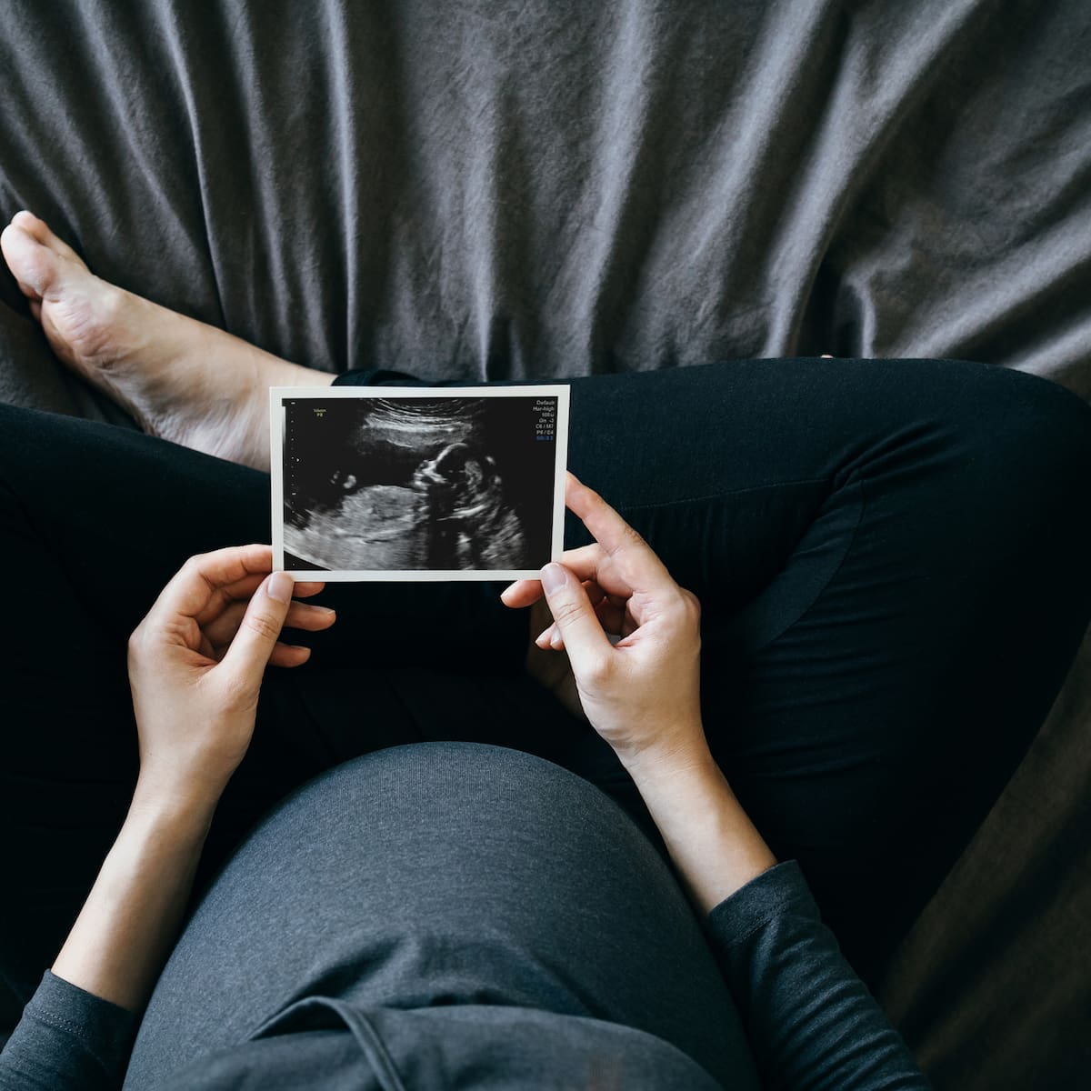 “Mamnesia”: el curioso efecto que afecta al 80% de las embarazadas y que la ciencia acaba de encontrar una explicación