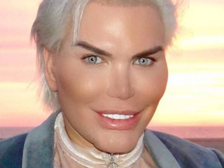 Ken Humano se inyectó nueve litros de glúteos para verse como las Kardashian y Jennifer López