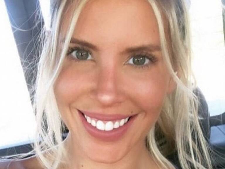 «Calzas de piel de naranja»: Coté López compartió foto con short y bromeó sobre su celulitis