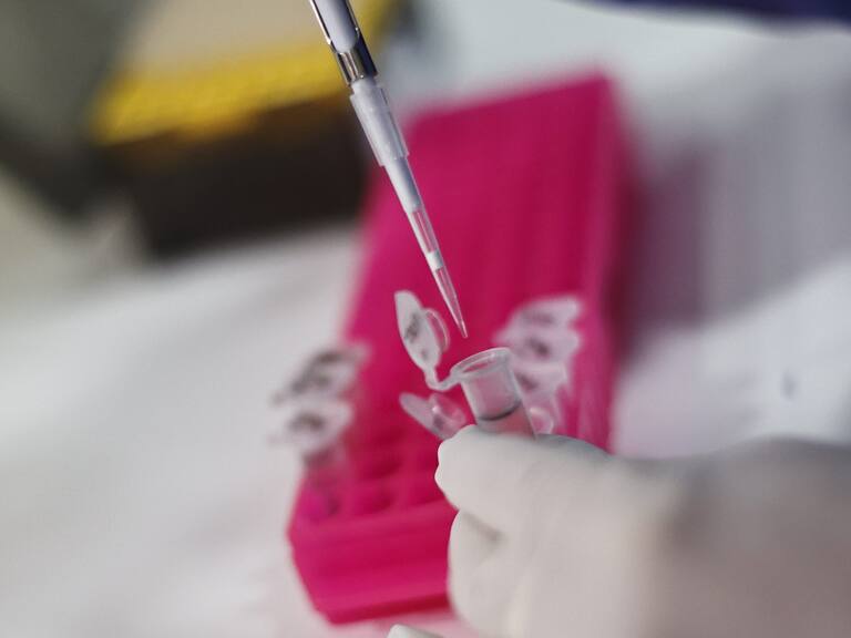 30 de mayo 2022/Santiago El Subsecretario de Salud Pública, Cristóbal Cuadrado, junto al director del ISP, Heriberto García, y la jefa del Departamento Laboratorio Biomédico Nacional y de referencia, Judith Mora, se refieren a los avances en capacidad diagnóstica de la Viruela Símica en Chile.
FOTO KARIN POZO/AGENCIA UNO