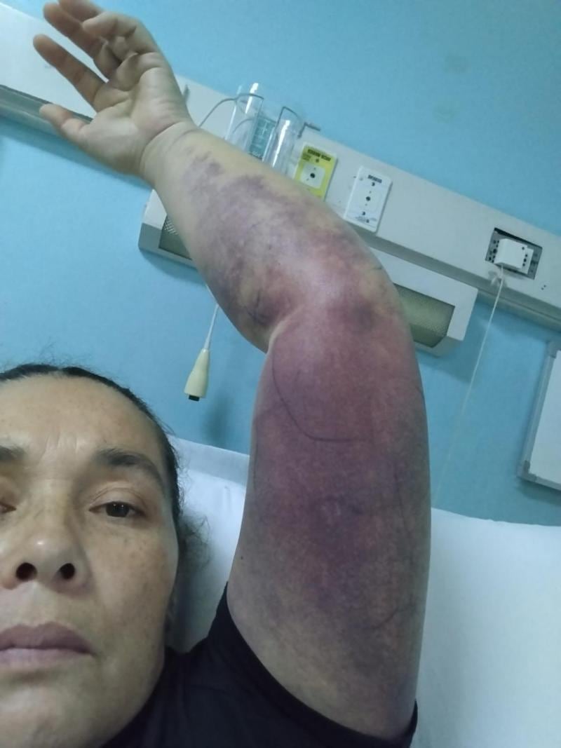 Culebra Putaendo