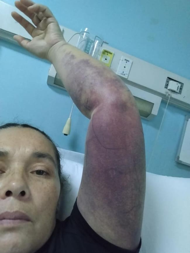 Culebra Putaendo