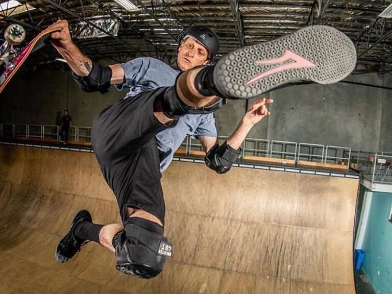 Tony Hawk compartió perturbadoras imágenes de lesión en su mano: «Tuvieron que cortarme el anillo» de boda
