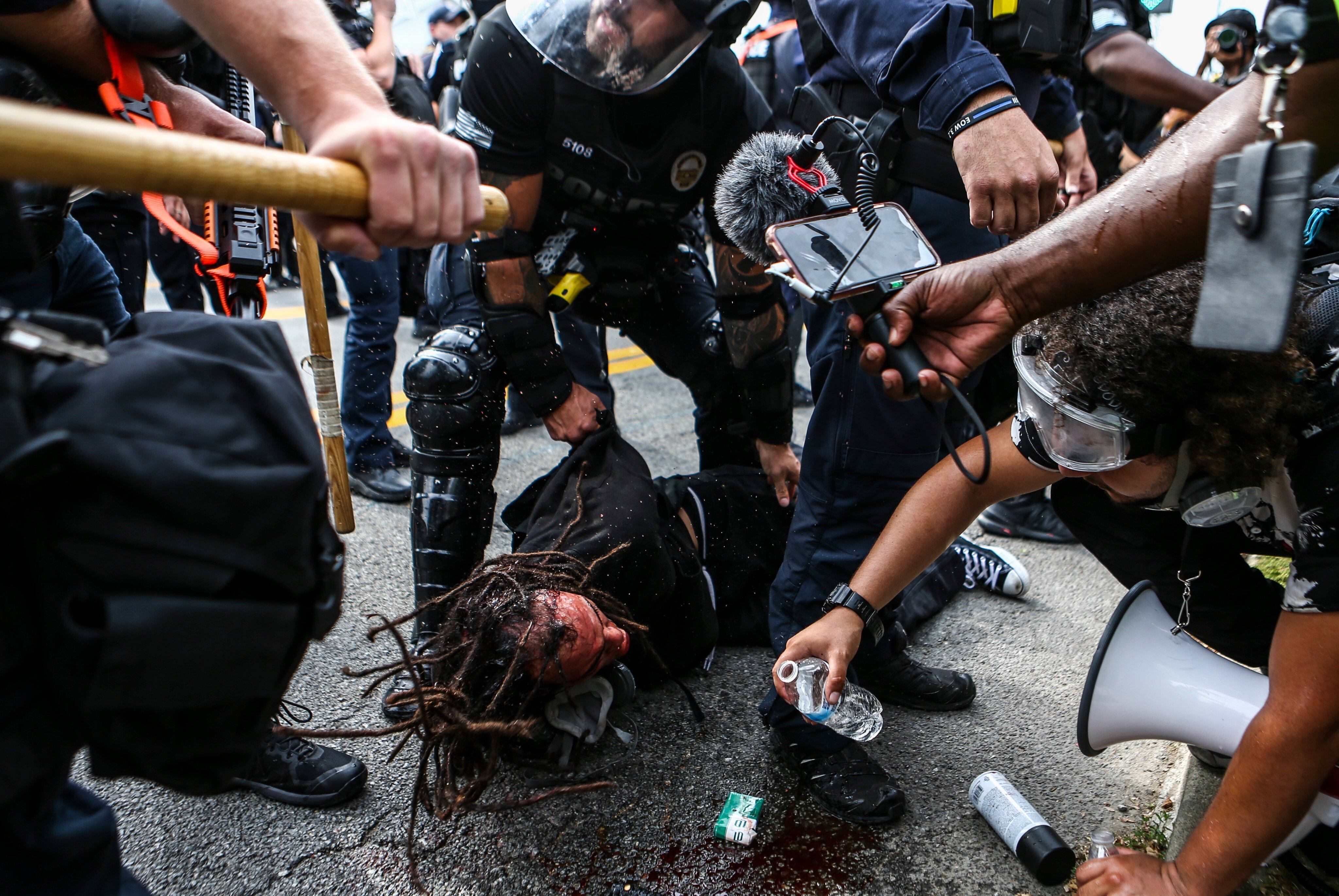 Represión policial en Louisville
