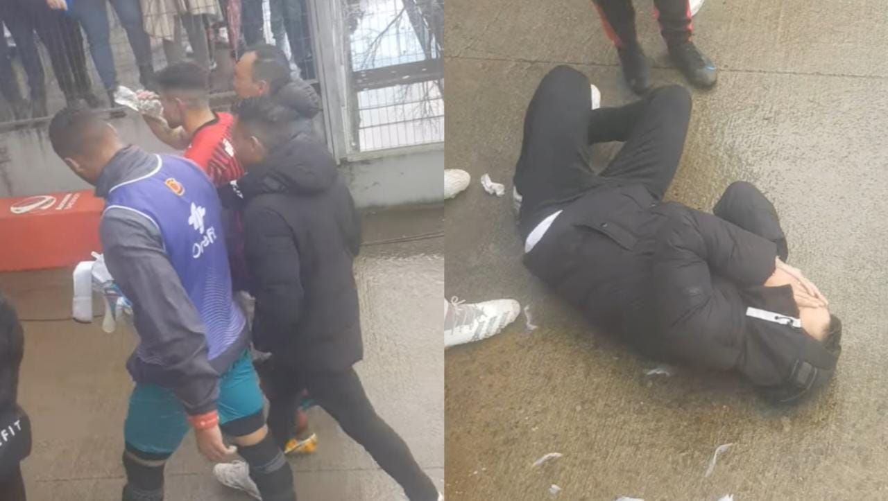 DT de Rangers recibe "proyectil" en el rostro y luego la dirigencia anuncia su destitución