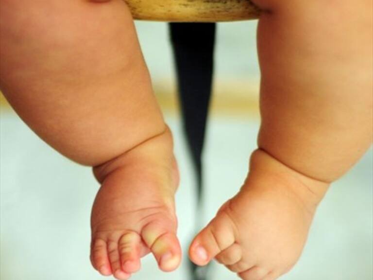 Bebé de ocho meses preocupa por sus 18 kilos de peso