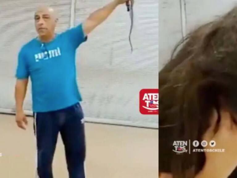 Padre denuncia que su hija sufrió graves quemaduras en la cabeza tras procedimiento en peluquería de Quilpué