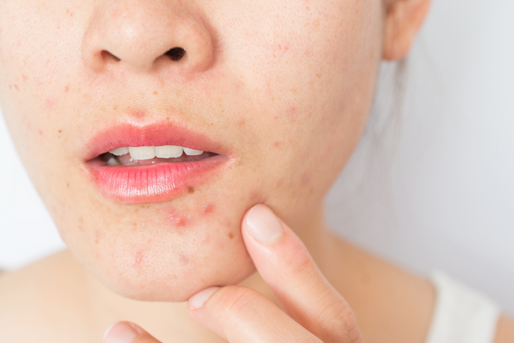 Conceptual of problems on woman skin.