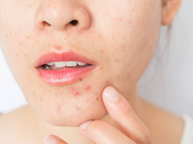 Conceptual of problems on woman skin.