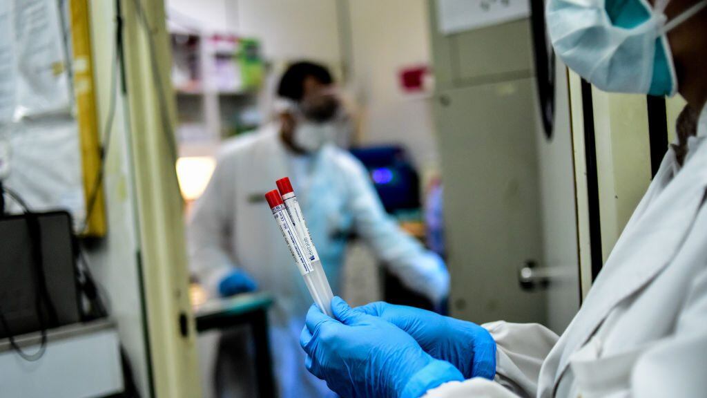 BUENOS AIRES, ARGENTINA - APRIL 28: Biochemist Daniela Beatriz Ori manipulates swab samples to make a real time polymerase chain reaction (RT-PCR) analysis for COVID-19 testing at the biochemistry lab of Central Navy Hospital Dr. Pedro Malloon April 28, 2020 in Buenos Aires, Argentina. The hospital, which is treating COVID-19 patients, has capacity to process up to 36 swab samples a day. (Photo by Amilcar Orfali/Getty Images)