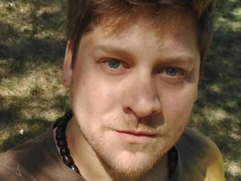 «Elfi», conocido exchico Yingo, preocupó a sus fans al mostrar grave inflamación en su rostro