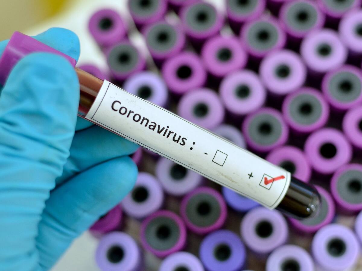 Minsal informó que hubo 2.616 nuevos casos y ya son 317.657 los contagiados con coronavirus