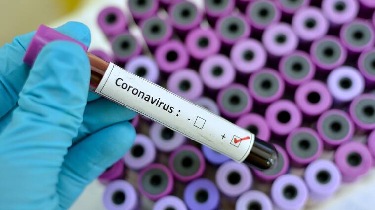 Blood sample with respiratory coronavirus positive