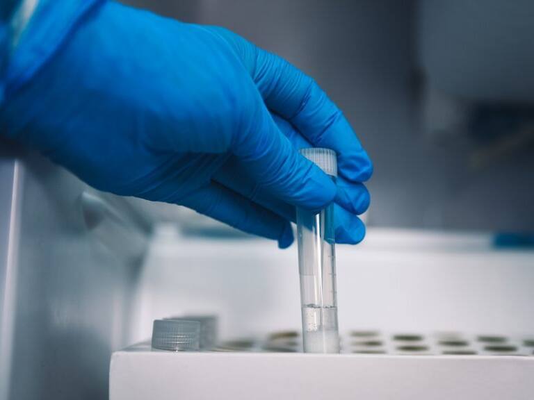 2 DE ABRIL 2021 / TEMUCO
Carro TTA contratado por Seremi de Salud que realiza cerca de 600 exámenes PCR que son analizados en el mismo lugar, entregando resultados en un tiempo máxmo de 24 horas.
FOTO: MARCOS MALDONADO / AGENCIAUNO