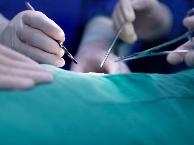 Cirugías pospuestas Chile 2022