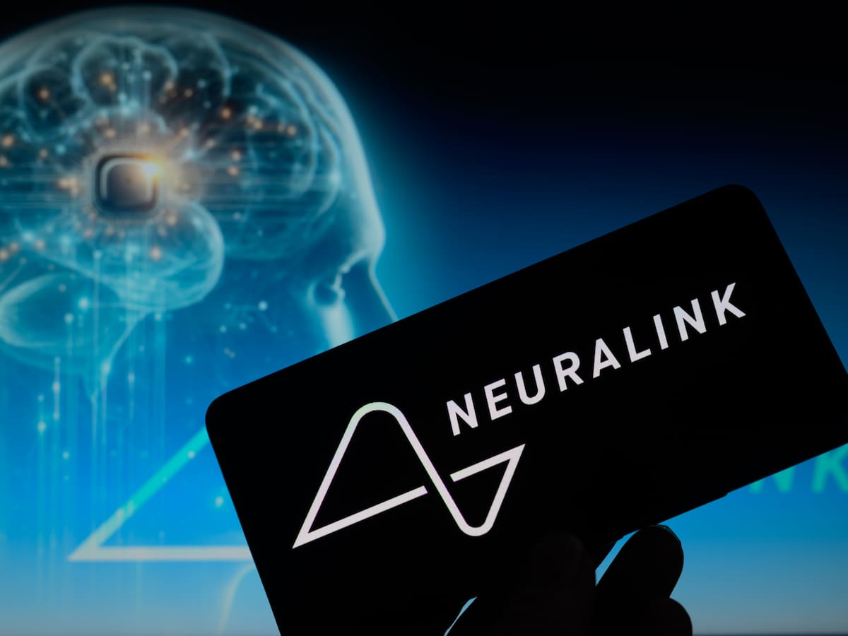 Telepathy: para qué sirve el chip cerebral impulsado por Elon Musk (y por qué es tan revolucionario)