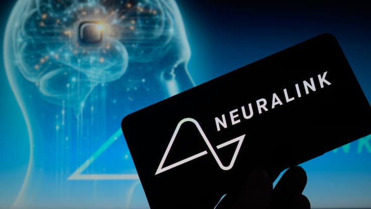 Telepathy: para qué sirve el chip cerebral impulsado por Elon Musk (y por qué es tan revolucionario)