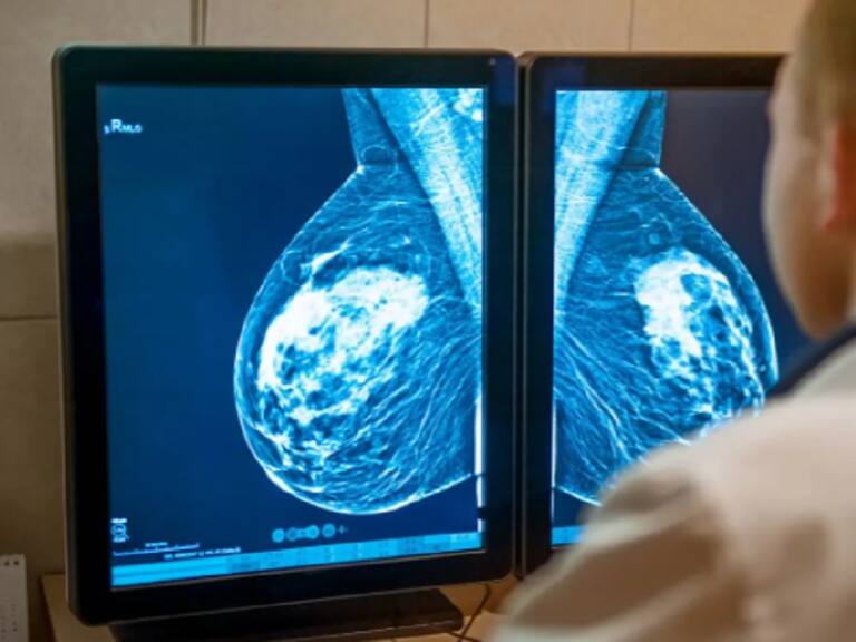 ¡Escándalo e indignación en el Biobío! Detectan 1.200 mamografías con resultados falsos: llaman a mujeres a repetirlas de forma urgente