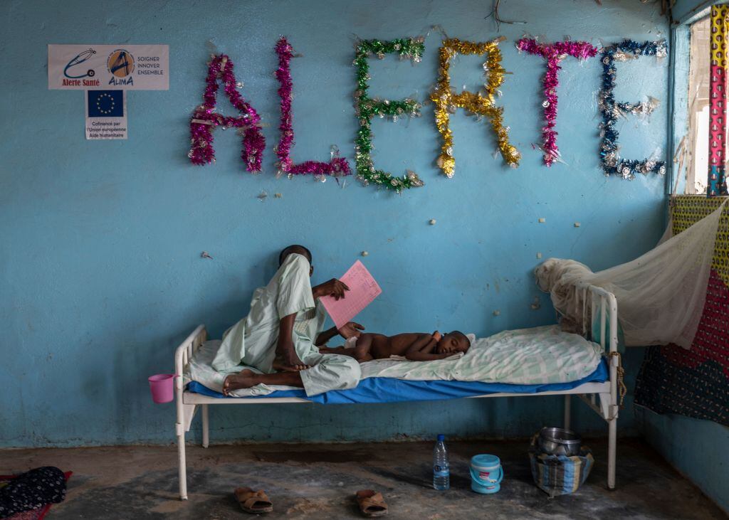 Padre acompaña a su hijo con mal nutrición atendido en hospital de Chad