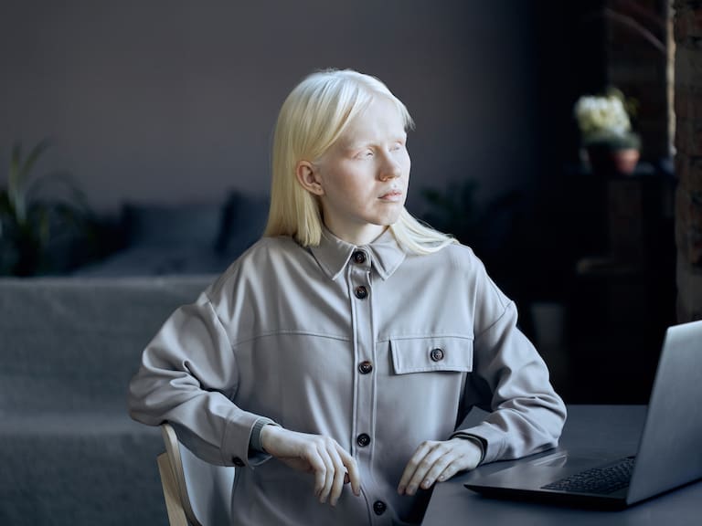 Chile da paso histórico en salud pública: personas con albinismo accederán gratis a bloqueador solar