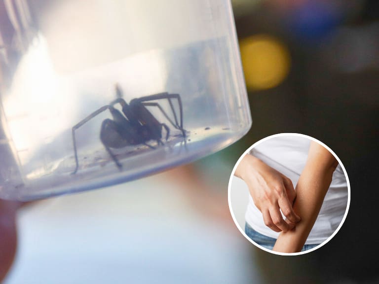 Arañas de rincón en Chile: así puedes diferenciar su mordedura de la de otros insectos
