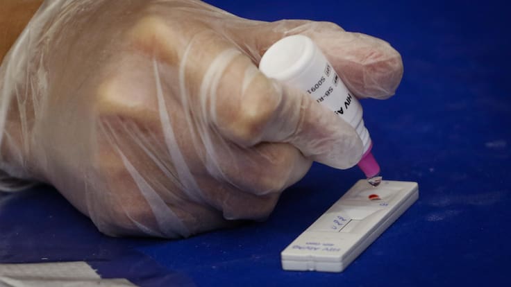 Realizarán test de VIH gratis y anuncia nuevos centros de salud en estaciones de Metro de alta afluencia