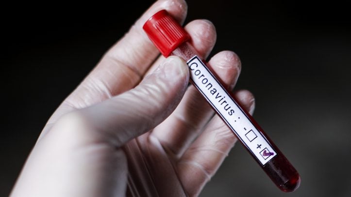 A doctor holds blood work tube about corona virus